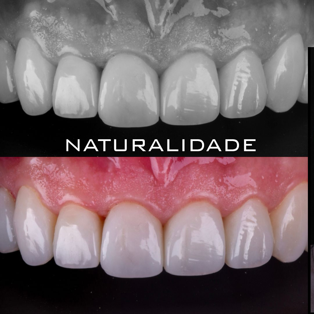 Caso 06