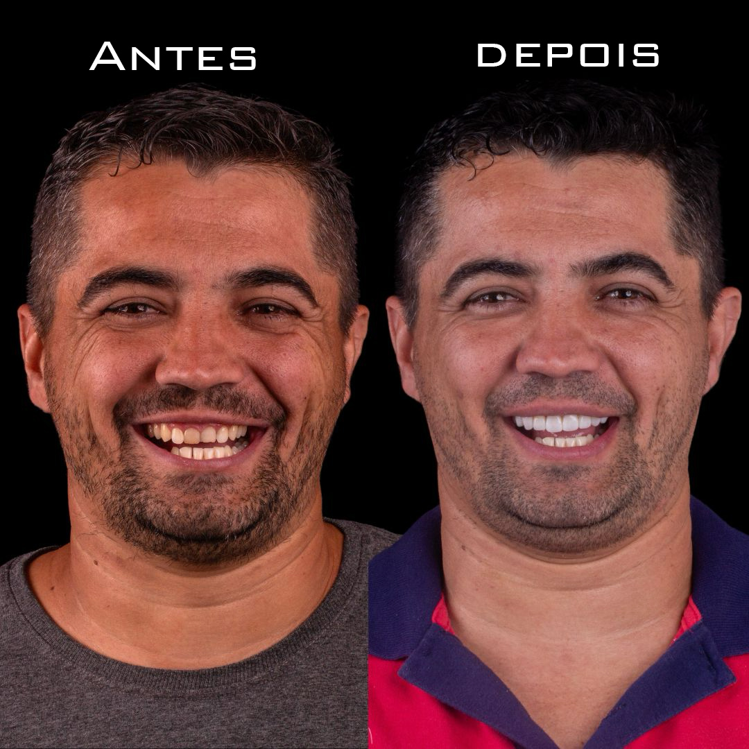 Caso 10